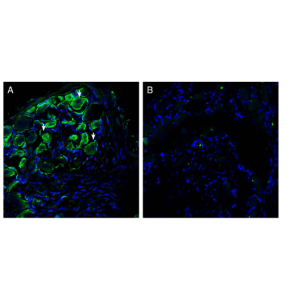 Anti-Piezo2 Antibody
