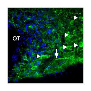 Anti-P2X1 Receptor Antibody