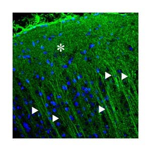 Anti-P2X2 Receptor Antibody