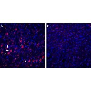 Anti-P2Y6 Receptor Antibody
