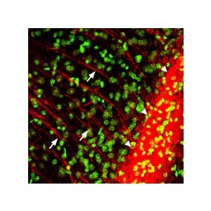 Anti-P2Y12 Receptor Antibody
