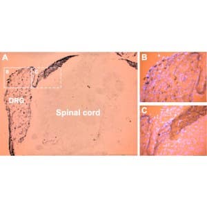 Anti-P2X3 Receptor Antibody