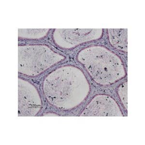 Anti-P2Y13 Receptor Antibody