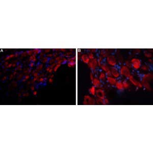 Anti-P2X3 Receptor (extracellular) Antibody