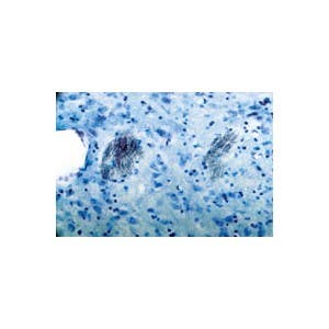 Anti-P2Y1 Receptor Antibody
