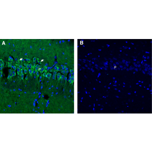 Synaptojanin 1 Blocking Peptide