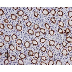 Anti-Aquaporin 2 Antibody
