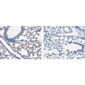 Anti-Aquaporin 5 Antibody