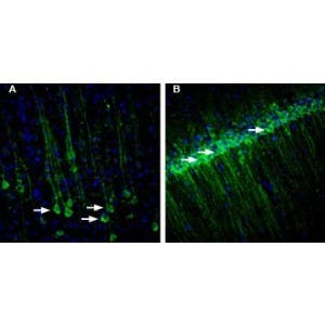 Anti-RAMP1 (extracellular) Antibody