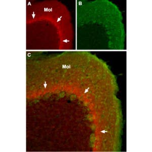 Anti-SCN1A (Na<sub>V</sub>1.1) Antibody