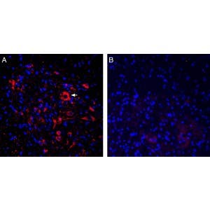 Anti-ASIC2a Antibody