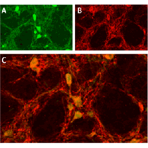 Anti-ASIC1 Antibody