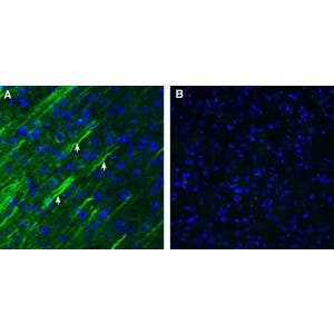 Anti-Somatostatin Receptor Type 1 (extracellular) Antibody