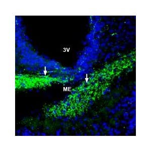 Anti-ZIP6/SLC39A6 (extracellular) Antibody