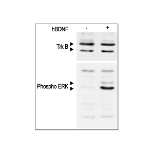 Recombinant human BDNF protein