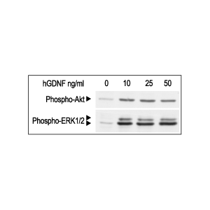 Recombinant human GDNF protein