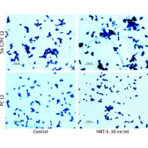 Recombinant human Neurotrophin-3 (NT-3) protein