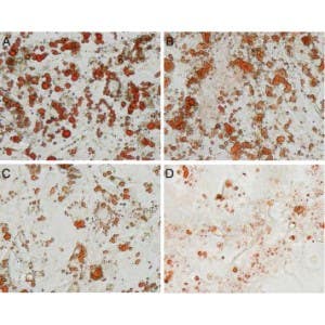Oligomycin