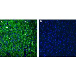 Rabbit IgG Isotype Control