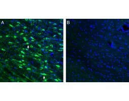 Anti-ACE2 (extracellular) Antibody