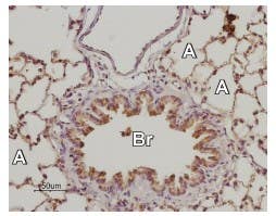 Anti-Adenosine A<sub>2B</sub> Receptor (extracellular) Antibody