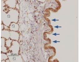 Anti-Adenosine A<sub>3</sub> Receptor Antibody