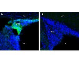 Anti-Adenosine A1 Receptor (extracellular) Antibody