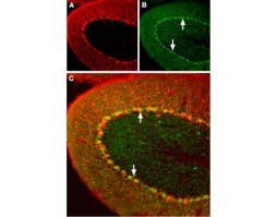 Anti-Angiotensin II Receptor Type-1 (extracellular) Antibody