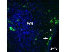 Anti-Angiotensin II Receptor Type-2 (extracellular)-ATTO Fluor-488 Antibody