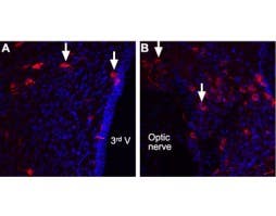 Anti-Angiotensin II Receptor Type-2 (extracellular) Antibody