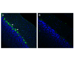 Anti-Renin Receptor/ATP6AP2 (extracellular) Antibody