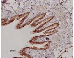 Anti-β<sub>2</sub>-Adrenergic Receptor (extracellular) Antibody