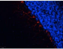 Anti-α<sub>1B</sub>-Adrenergic Receptor (extracellular) Antibody