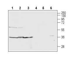 Anti-Human C5aR1 (extracellular) Antibody