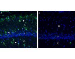Anti-C5aR2 (extracellular) Antibody