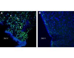 Anti-C3aR1 (extracellular) Antibody