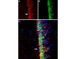 Anti-Adenylate Cyclase 3 (AC3) (extracellular) Antibody