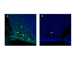 Anti-Adiponectin Receptor 1 Antibody