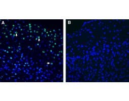 Anti-Neuronal Pentraxin 2 (NPTX2) Antibody
