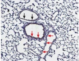 Anti-Bestrophin-1 (extracellular) Antibody