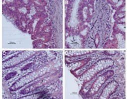 Anti-Bombesin Receptor 2 (GRPR) (extracellular) Antibody