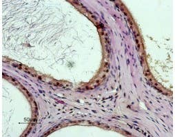 Anti-Bombesin Receptor 3 (extracellular) Antibody