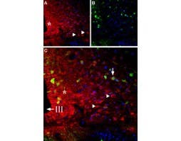 Anti-Bombesin Receptor 1 (NMBR) Antibody