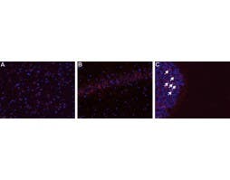 Anti-B<sub>1</sub> Bradykinin Receptor (BDKRB1) Antibody