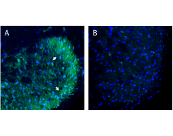 Anti-B1 Bradykinin Receptor (BDKRB1) (extracellular) Antibody