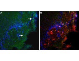 Anti-BAI1 (extracellular) Antibody
