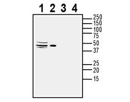 Anti-ACVRL1 (extracellular) Antibody