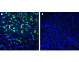 Anti-BMPR1A (extracellular) Antibody