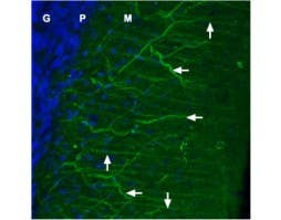 Anti-Ca<sub>V</sub>1.2 (CACNA1C)-ATTO Fluor-488 Antibody