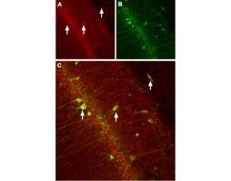 Anti-CACNB3 Antibody